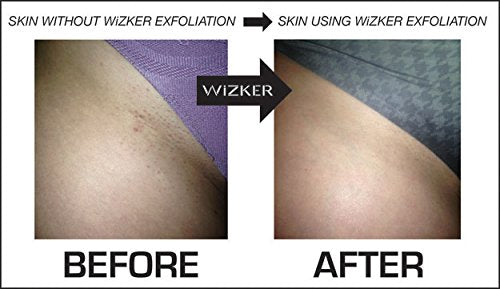 WIZKER® Premium Ingrown Hair Exfoliating Brush: Soft + Firm Face Body Scrubber, Sensitive Skin Exfoliator, Prevents Razor Bumps, Shave, Laser, Wax