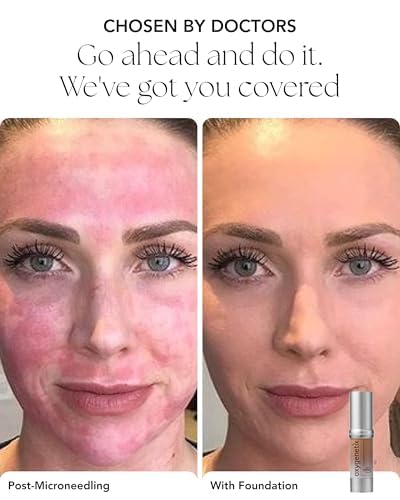 Oxygenetix Oxygenating Foundation - Tawny | Breathable Makeup for Face | Buildable Coverage with Weightless Feel | Longwear Foundation for Women |