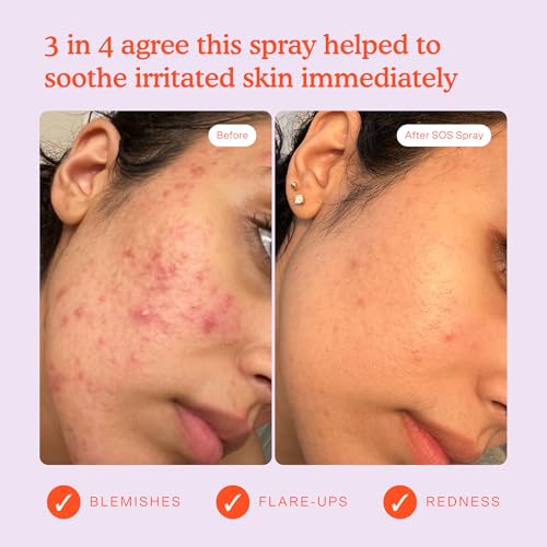 Tower 28 SOS Daily Rescue Facial Spray 4 oz – Hypochlorous Acid Toner for Sensitive Skin, Reduces Redness & Breakouts, Soothing Face Spray