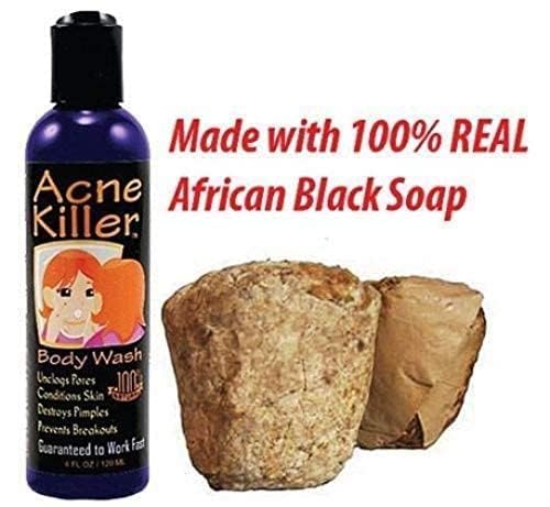 Acne Killer Black Soap Body Wash - 4 floz Beauty & Personal Care Acne Killer