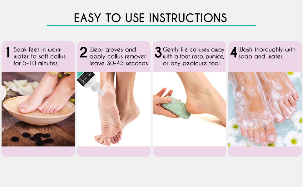 Karlash Callus Remover Gel for Feet and Foot Pumice Stone Scrubber Kit Remove Hard Skins Heels and Tough Callouses from feet Quickly and Effortless 4 Beauty & Personal Care Karlash