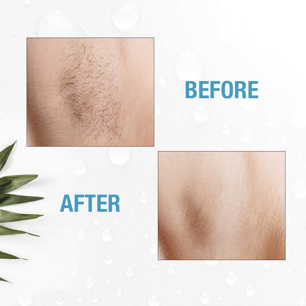 Clean + Easy Electrolysis Machine for Permanent Hair Removal - Non-Laser, Painless Electrolysis Hair Removal for Face & Body, At-Home Remover Device