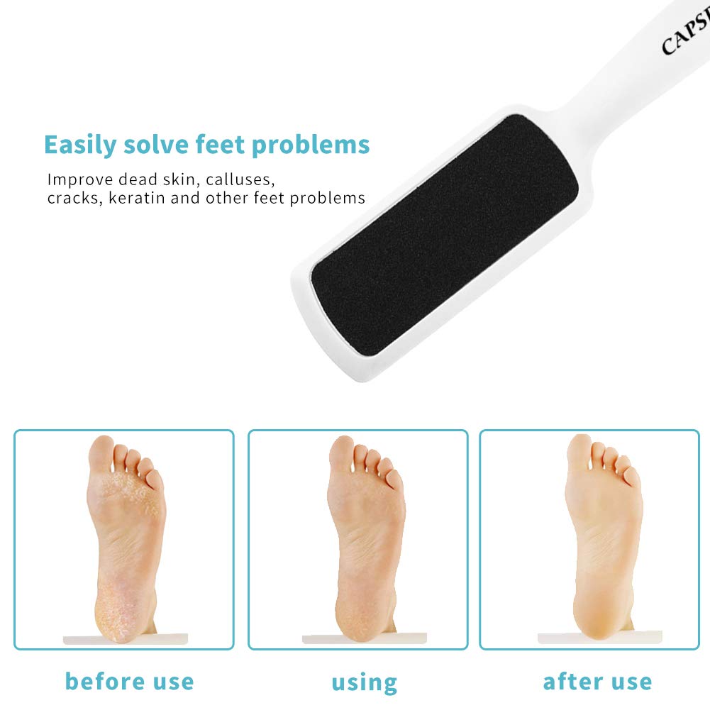 Pedicure Foot Rasp File Callus Remover, Double-Sided Colossal Foot Rasp Foot File And Callus Remover For Dead Skin (Pack of 4)