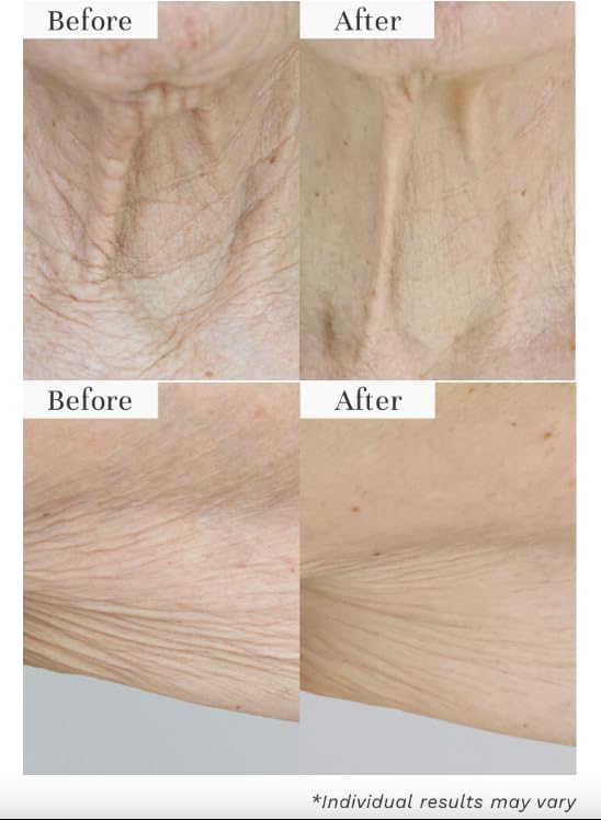 City Beauty InvisiCrepe Body Balm - Skin Firming & Tightening Lotion for a Smoother, Firmer Look | Anti-Aging Firming Body Cream