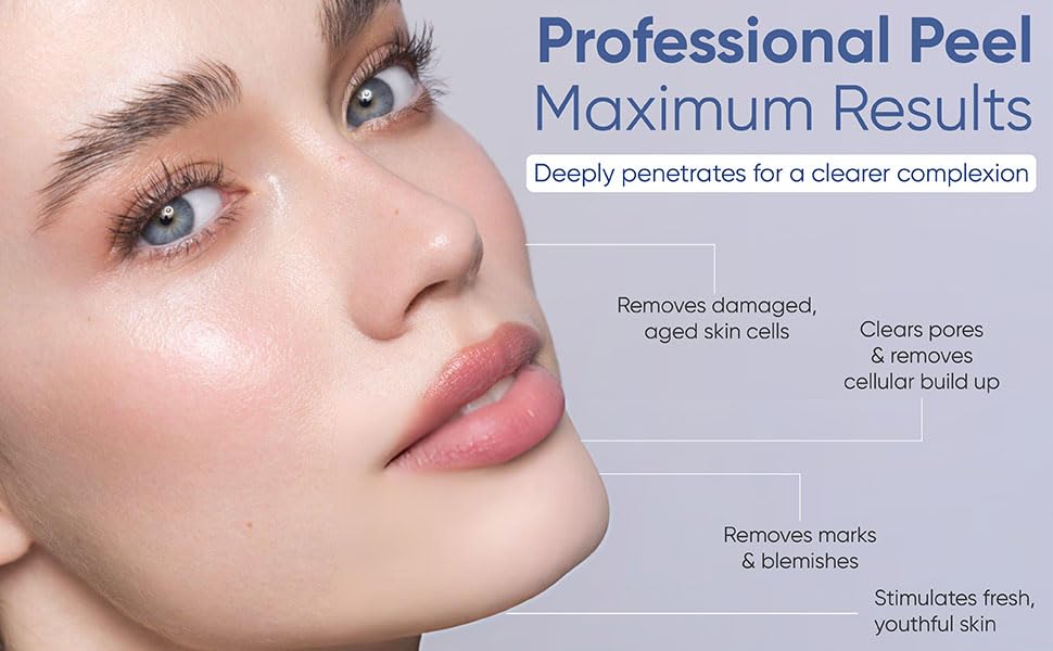 SKIN PEEL 4000 - Chemical Skin Peel Kit | Created in1937 | Gets rid of acne scars, blemishes, large pores, fine lines, sun damage in only 6 days!