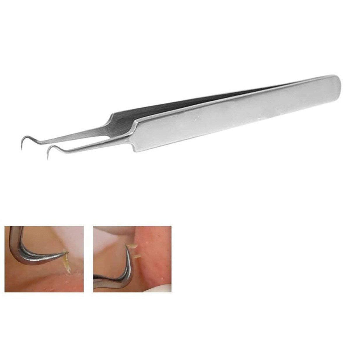 BEUKING Acne Blemish Blackhead Comedone Stainless Steel Nipper Blemish Extractor Tool for Remove Blackhead Acne Whitehead Pimple Bend Curved Tweezers