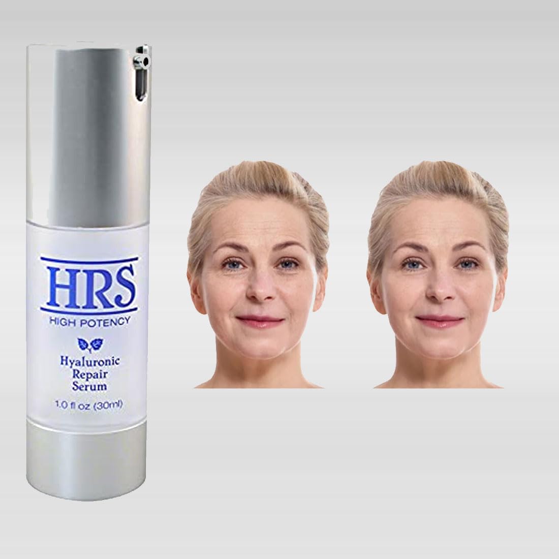 Hyaluronic Repair Concentrate High Potency by BioLogic Solutions (1 fl oz)