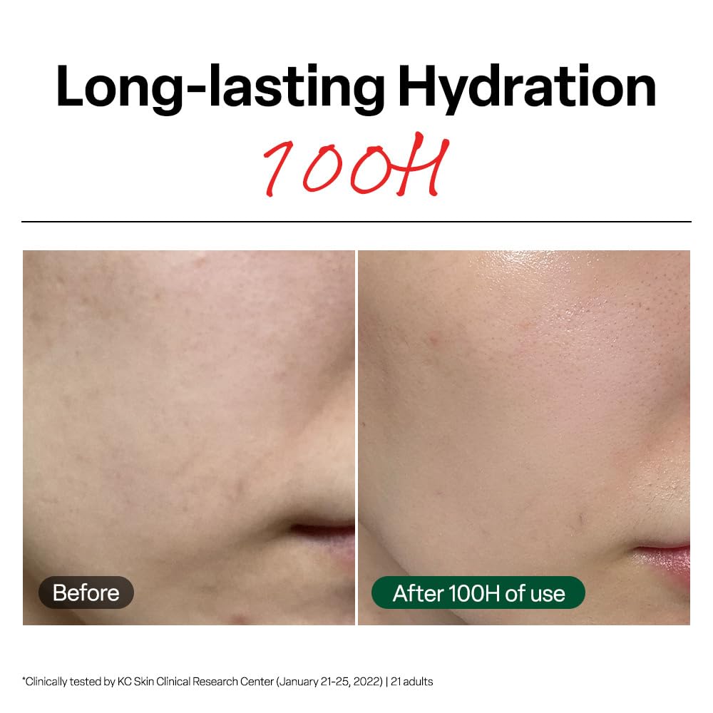 Dr. G R.E.D. Blemish Clear Soothing Cream - Calming Korean Moisturizer for Redness - Soothes Acne & Irritation - With Centella Asiatica - Long-Lasting