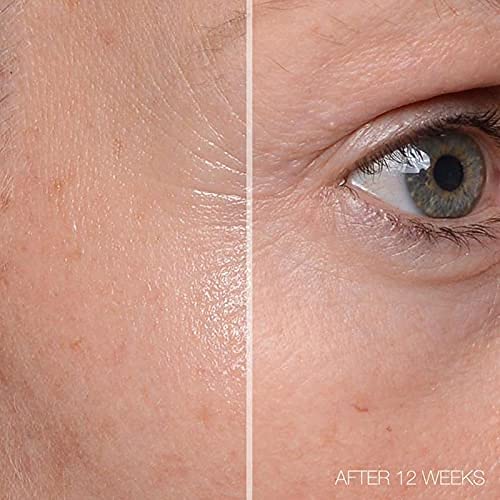 MD Complete Total Eye Treatment | Anti-Aging Hydrating Skin Renewal Eye Treatment | with Peptides, Vitamins C & E and Hyaluronic Acid for Wrinkles