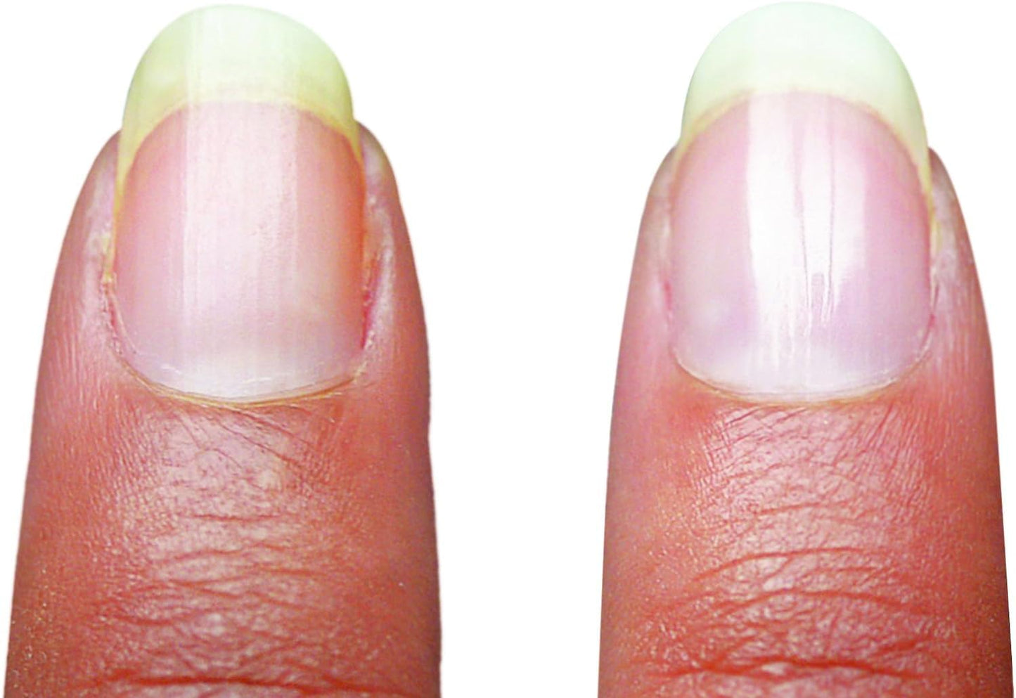 Emjoi Micro Nail Manicure or Mani Pedi--Smooths, Buffs & Shines Instantly