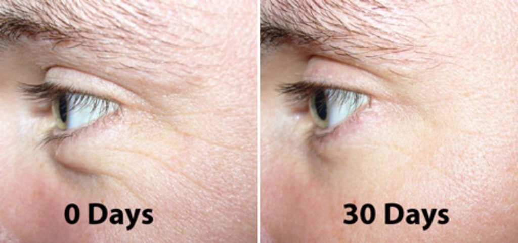 DNA Code® Matrixyl 3000 Peptide Anti Wrinkle Serum w/Argireline, Hyaluronic Acid, CoQ10 Beauty & Personal Care DNA Code