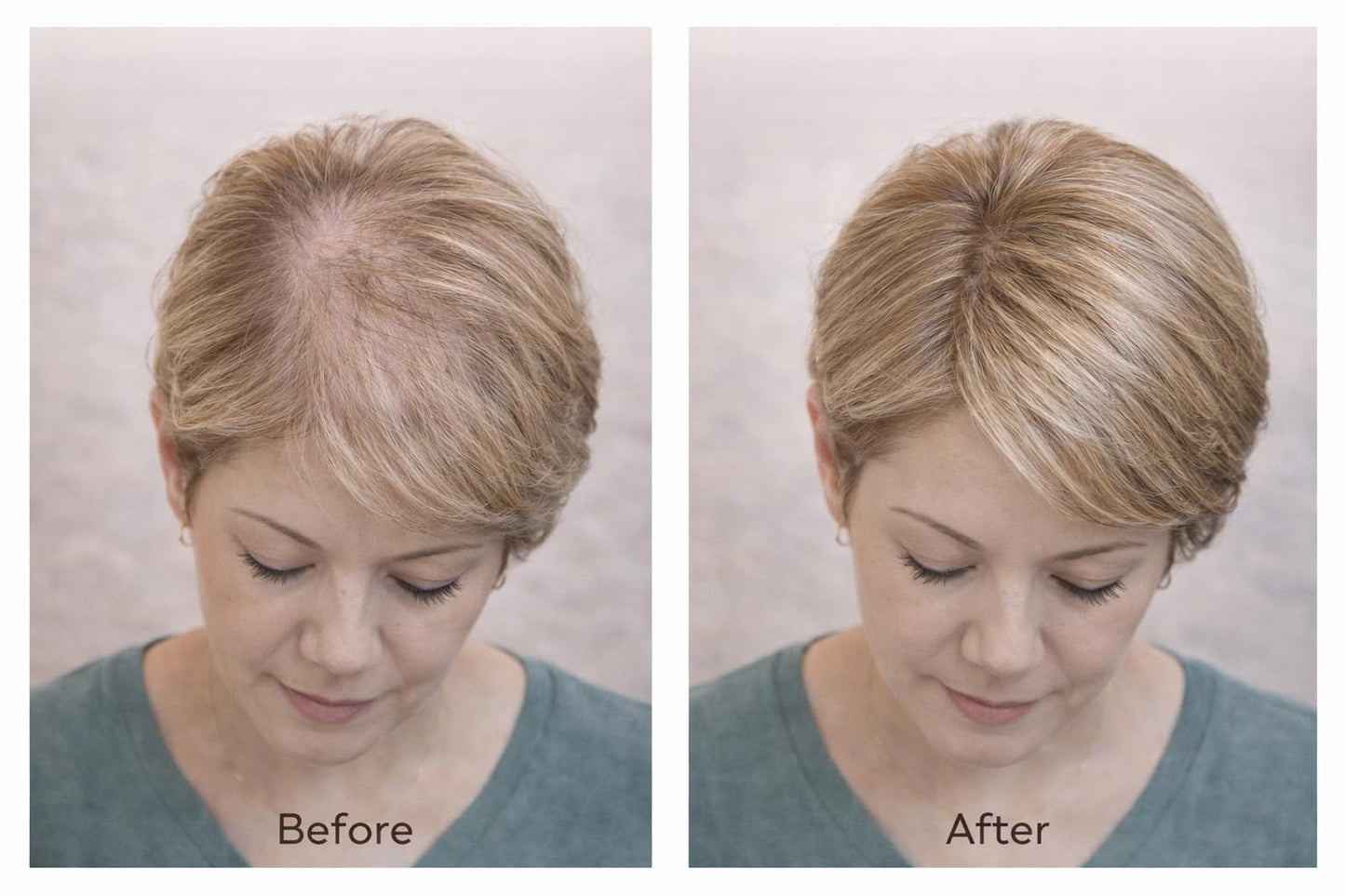Dark Blonde Hair Building Fiber - Natural Density for Thinning Hair - Fuller Looking Coverage