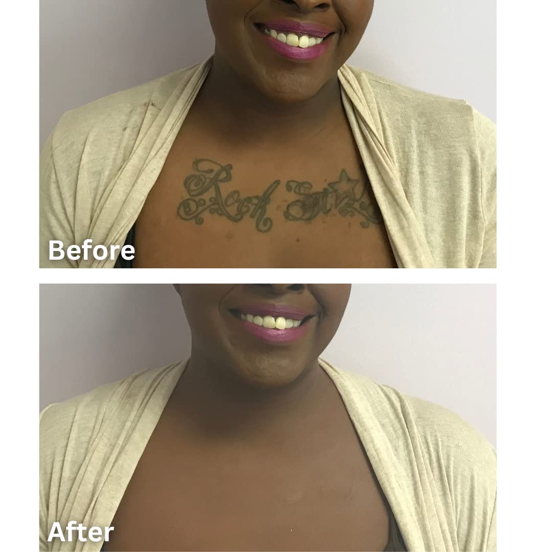 Dermaflage Tattoo Cover Up Makeup (Dark) - Bruise Full Coverage Concealer - Full Coverage Waterproof Concealer for Bruise, Scars & Acne - Smudge Proof