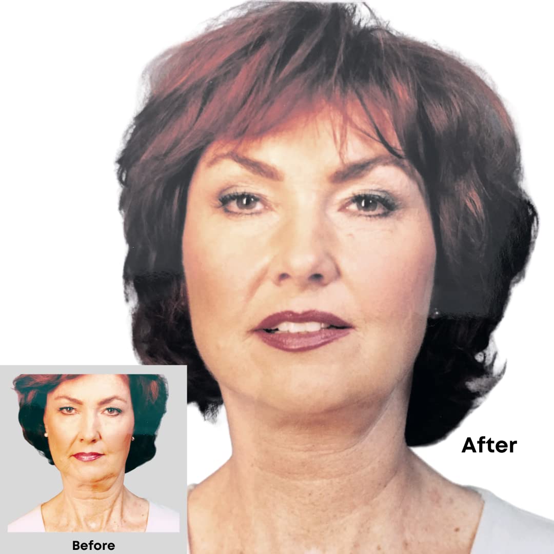 Bring It Up Instant Face Lift Tape Kit: 30-Day Supply, Transparent Neck & Eyebrow Lift Strips, Anti-Wrinkle Stickers, Face Tape Instantly Lifts