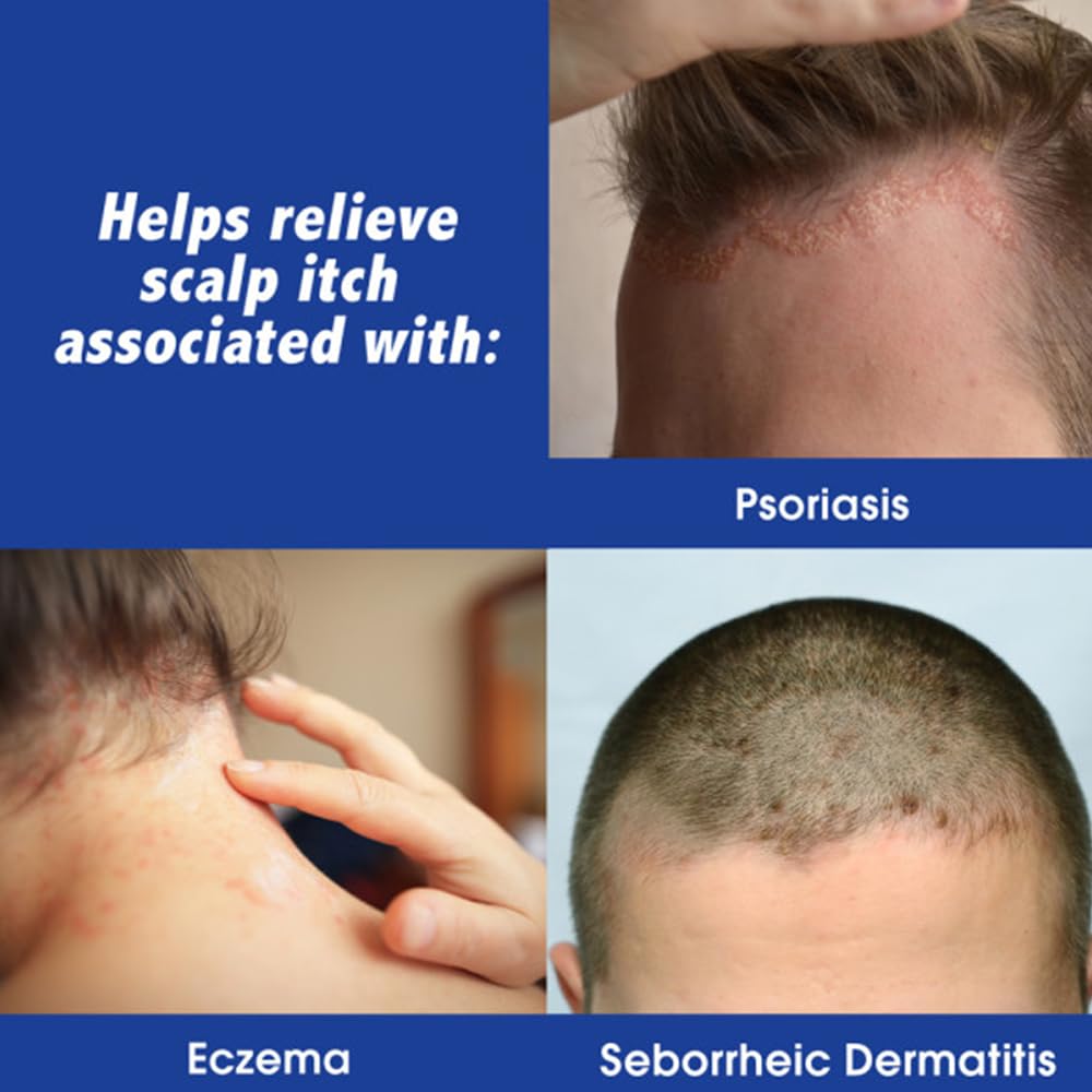Scalpicin Maximum Strength Scalp Treatment Liquid for Itchy Scalp, Seborrheic Dermatitis & Psoriasis Scalp Treatment, Fragrance-Free, 1.5 fl oz Beauty and Personal Care Scalpicin