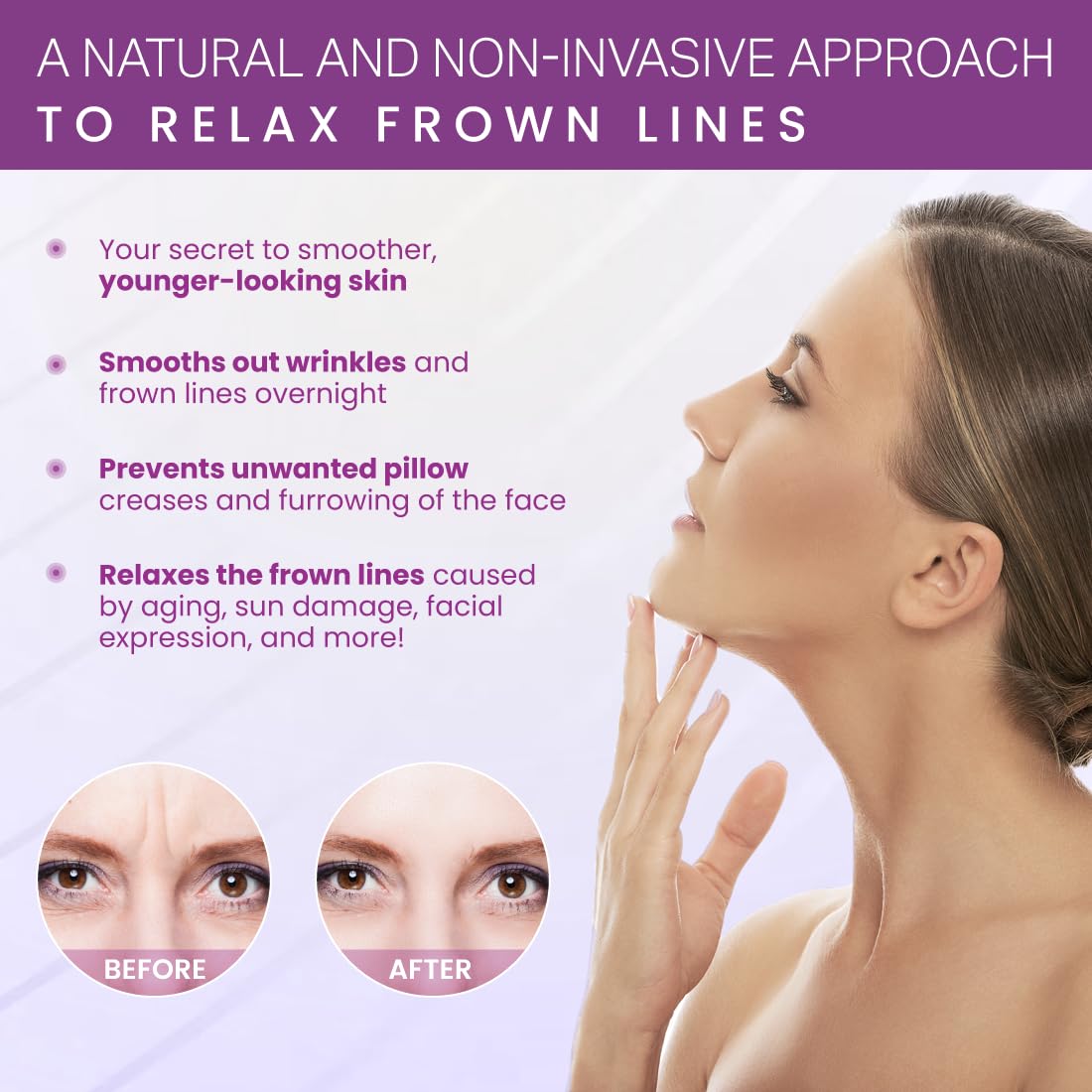 Furlesse Elevens Wrinkle Patches – 30 Non-Invasive Overnight Anti-Wrinkle Patches for Frown Lines, Anti-Aging Skincare, 30-Day Supply