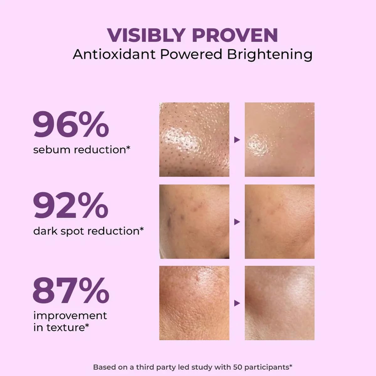 Conscious Chemist® Niacinamide Face Wash | 100ml | Pore Refining & Brightening Cleanser for Men & Women | With Blueberry & Açaí Berry Extracts | All