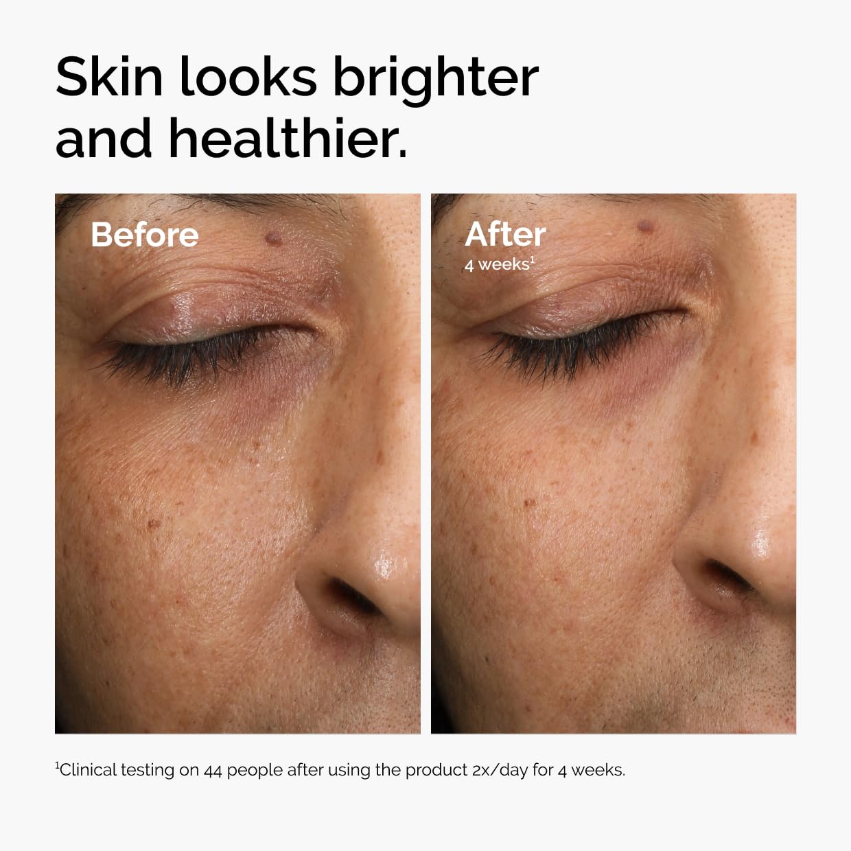 The Ordinary Multi-Antioxidant Radiance Serum, Vitamin C Serum For Face, Brighten & Protect Skin - Boosts Glow & Shields Against Environmental Beauty and Personal Care The Ordinary