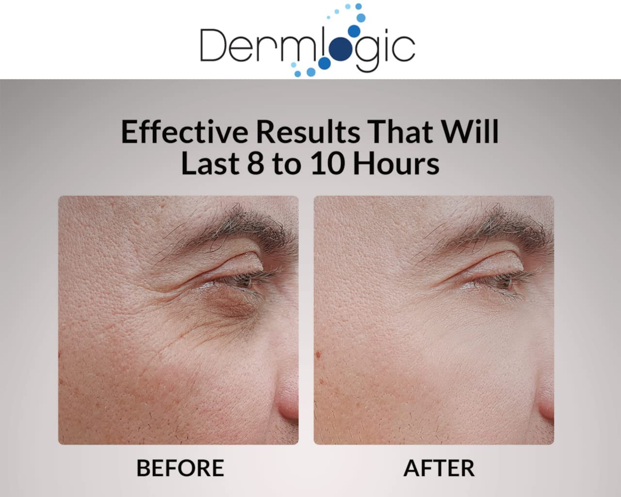 Under Eye Puffiness & Dark Circles Rapid Treatment- Instantly Reduces the Appearance of Puffy Eye Bags, Crow’s Feet, & Sagging Skin.