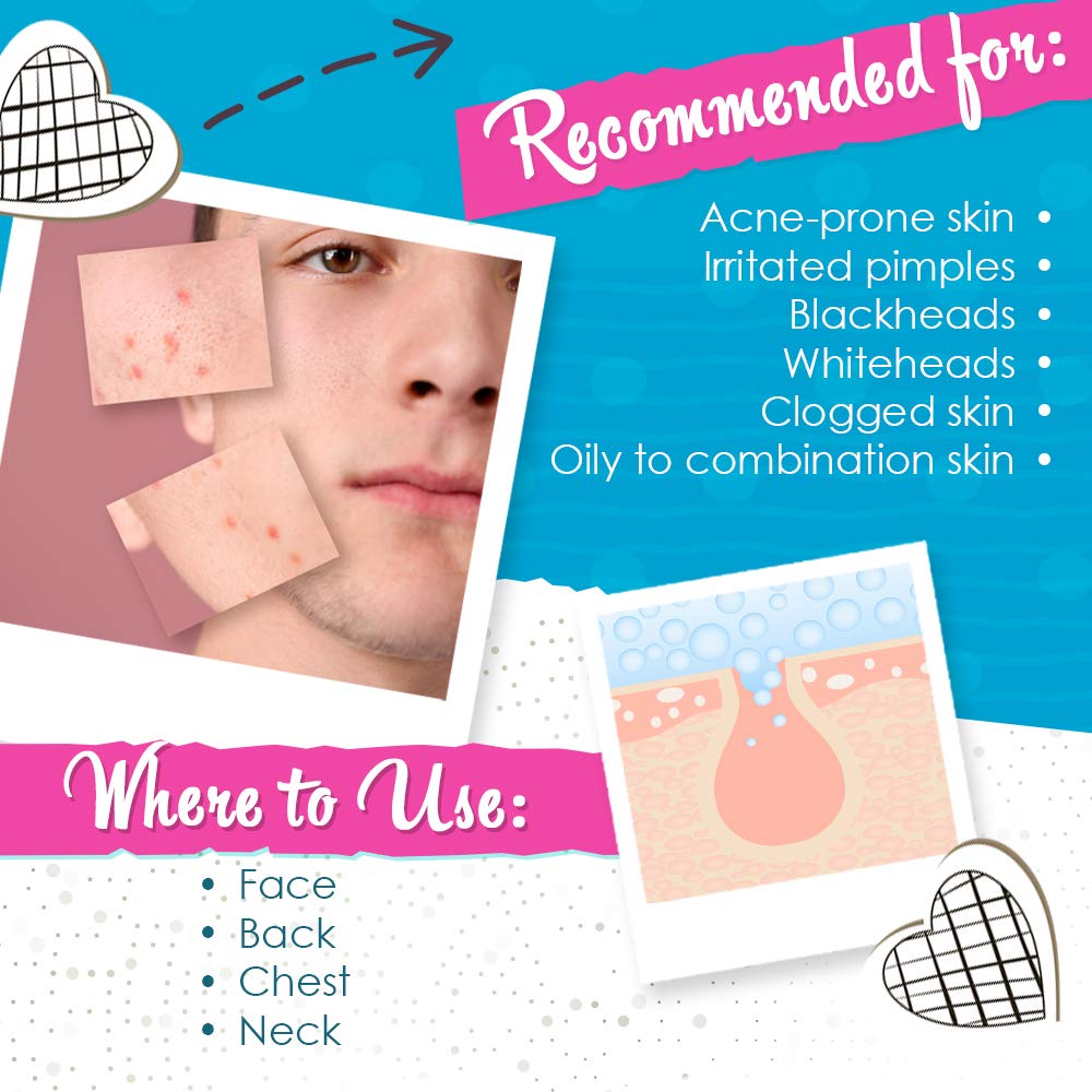 Bye Bye Blemish Acne Drying Lotion, On-the-Spot Pimple Treatment, Reduce Pimples Overnight, Beauty Skincare Essential - 1oz. (2-Pack)