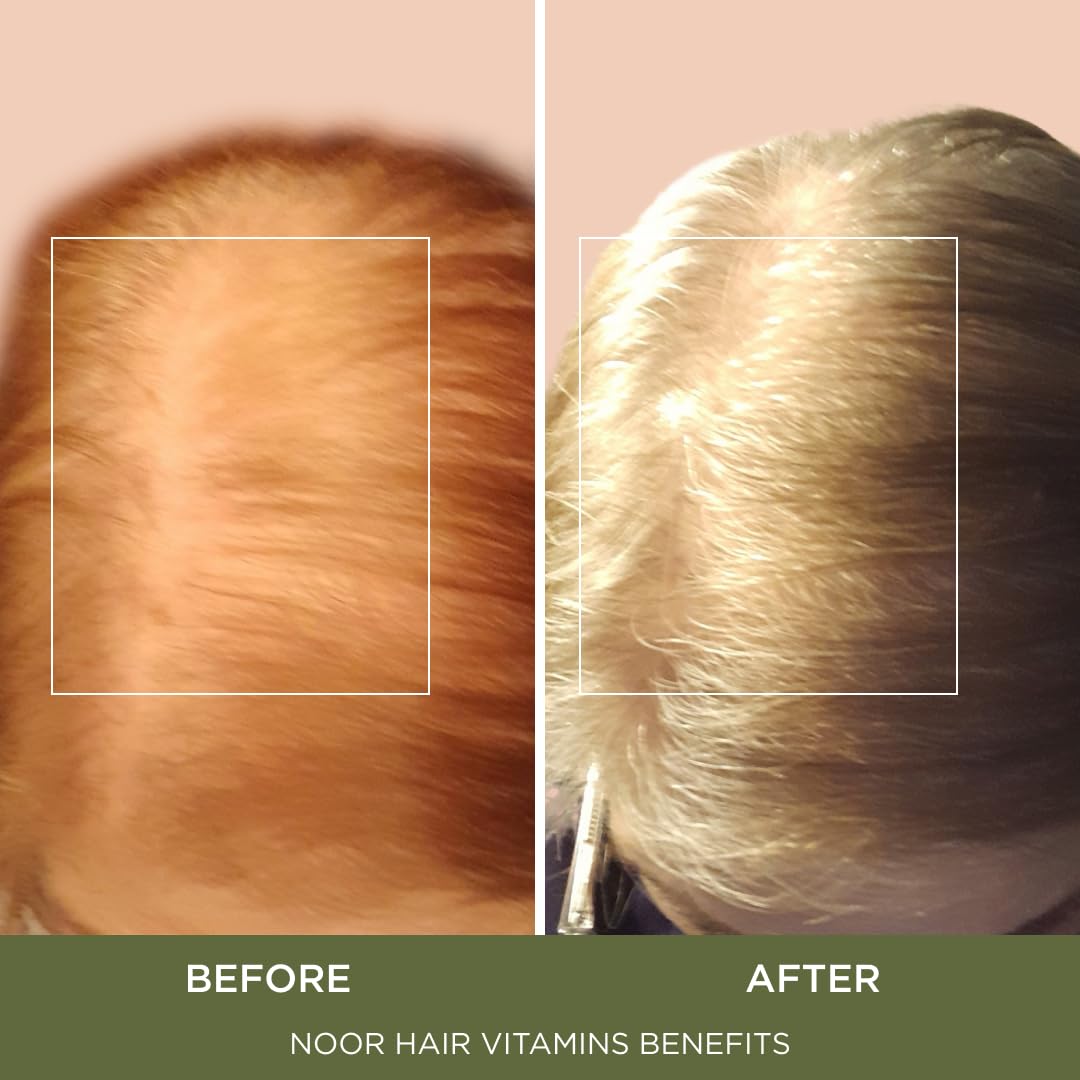 NOOR HAIR Healthy Hair Formula, Hair Growth Supplement Supporting Thick Hair and Fast Hair Regrowth. Vitamin C, B6, Zinc, Propietary Non-GMO & Gluten Beauty and Personal Care NOOR HAIR