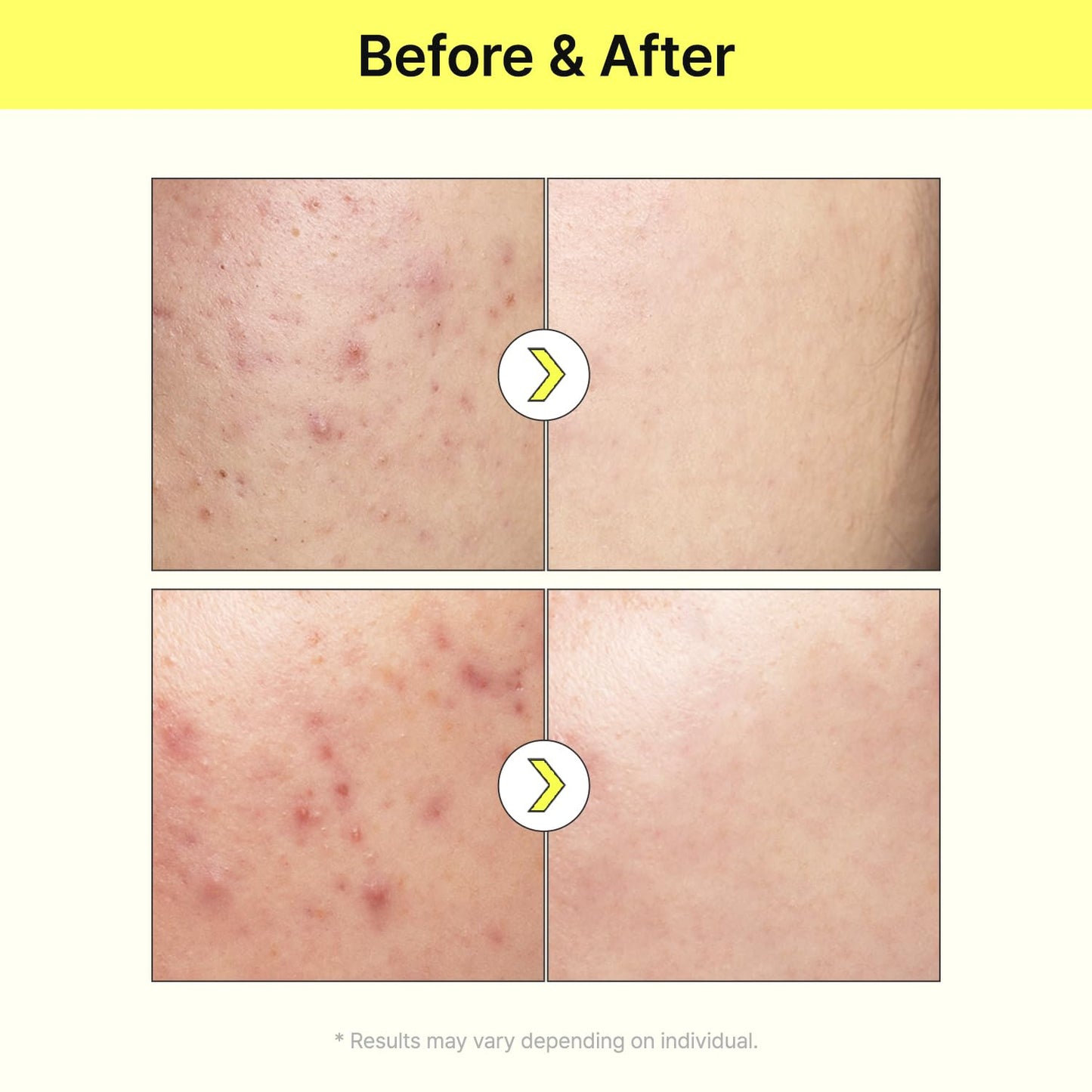 TIA'M Vita B3 Source, 1.35 fl oz, 10% Niacinamide Glow Serum with 2% Arbutin for Radiant & Balanced Skin, Vegan Korean Skin Care