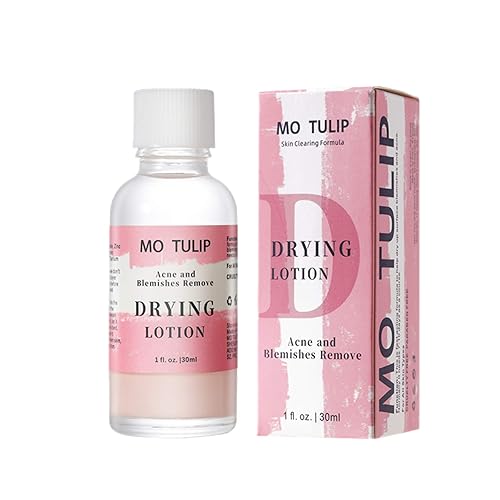 MO TULIP Acne Drying Lotion, Overnight Acne Acid and Acne Spot Treatment for Face and Body, Pimple Lotion Spot Treatment, Dry Out Pimples, Blemishes