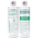 Eczema Cream Shampoo and Conditioner Scalp Treatment for Sensitive Skin for Kids & Adults- Colostrum & Colloidal Oatmeal -Itchy Scalp Anti Dandruff