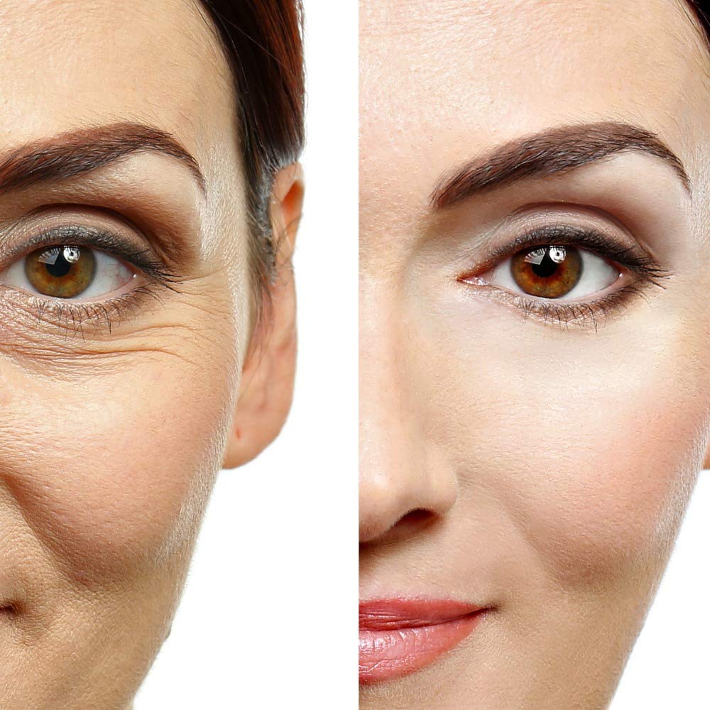 Eye Gel, for Dark Circles, Puffiness, Wrinkles, Skin Firming and Bags - Effective Anti-Aging Eye Gel for Under and Around Eyes including Crows Feet