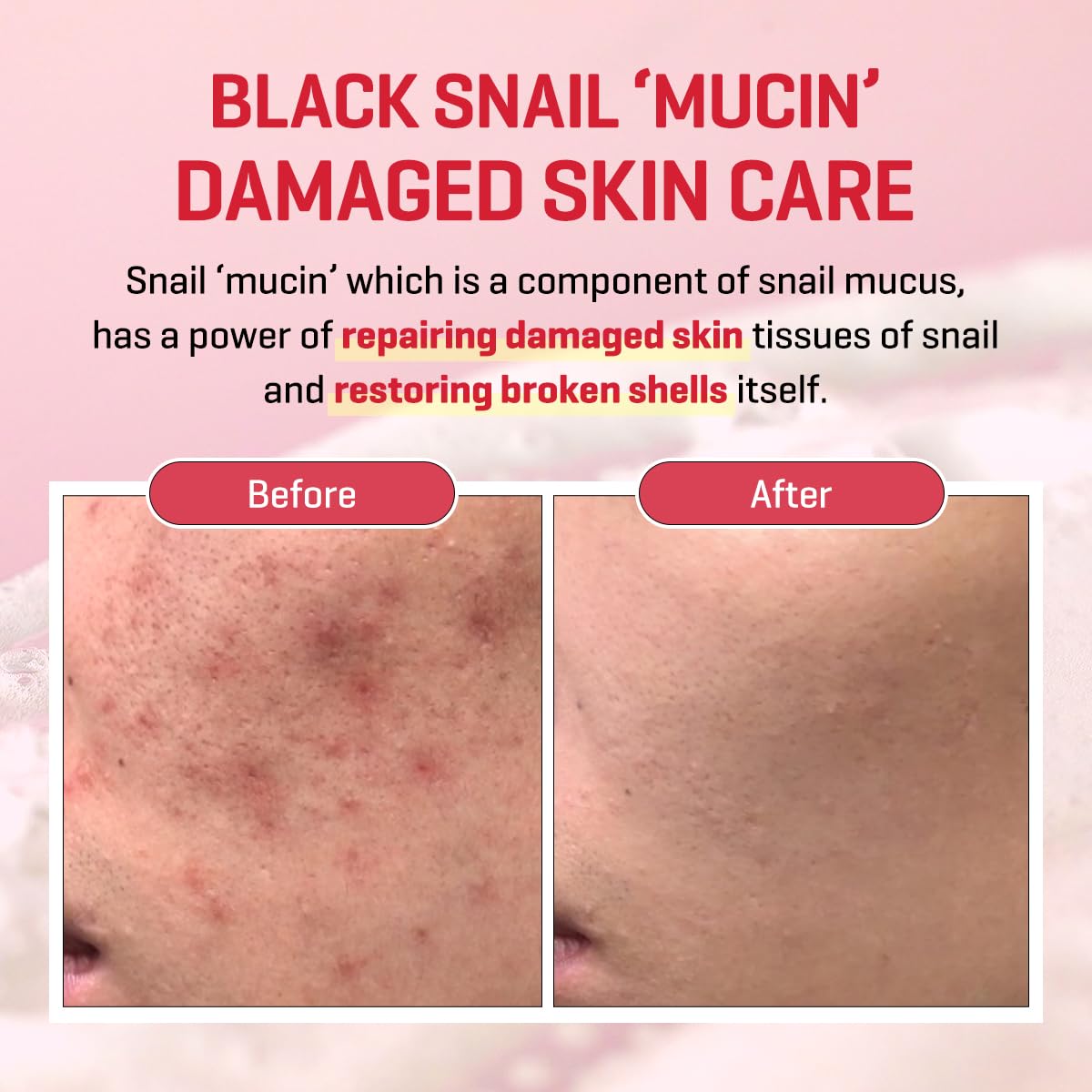 SOME BY MI Snail Trucica Miracle Repair Serum - 1.69Oz, 50ml - Made from Snail Mucin for Sensitive Skin - Daily Repair Face Serum for Post Acne Marks