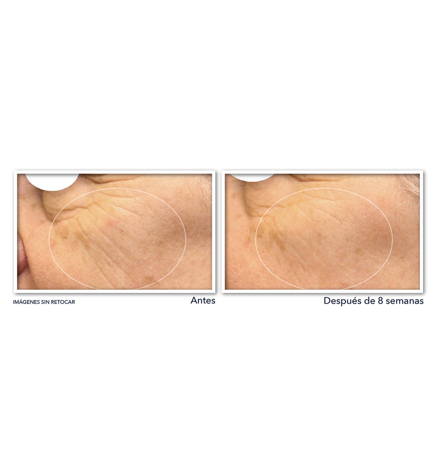 RoC Multi Correxion Revive + Glow 20% Pure Vitamin C Night Serum Capsules for Brightening, Dark Spots, and Texture, 30 count