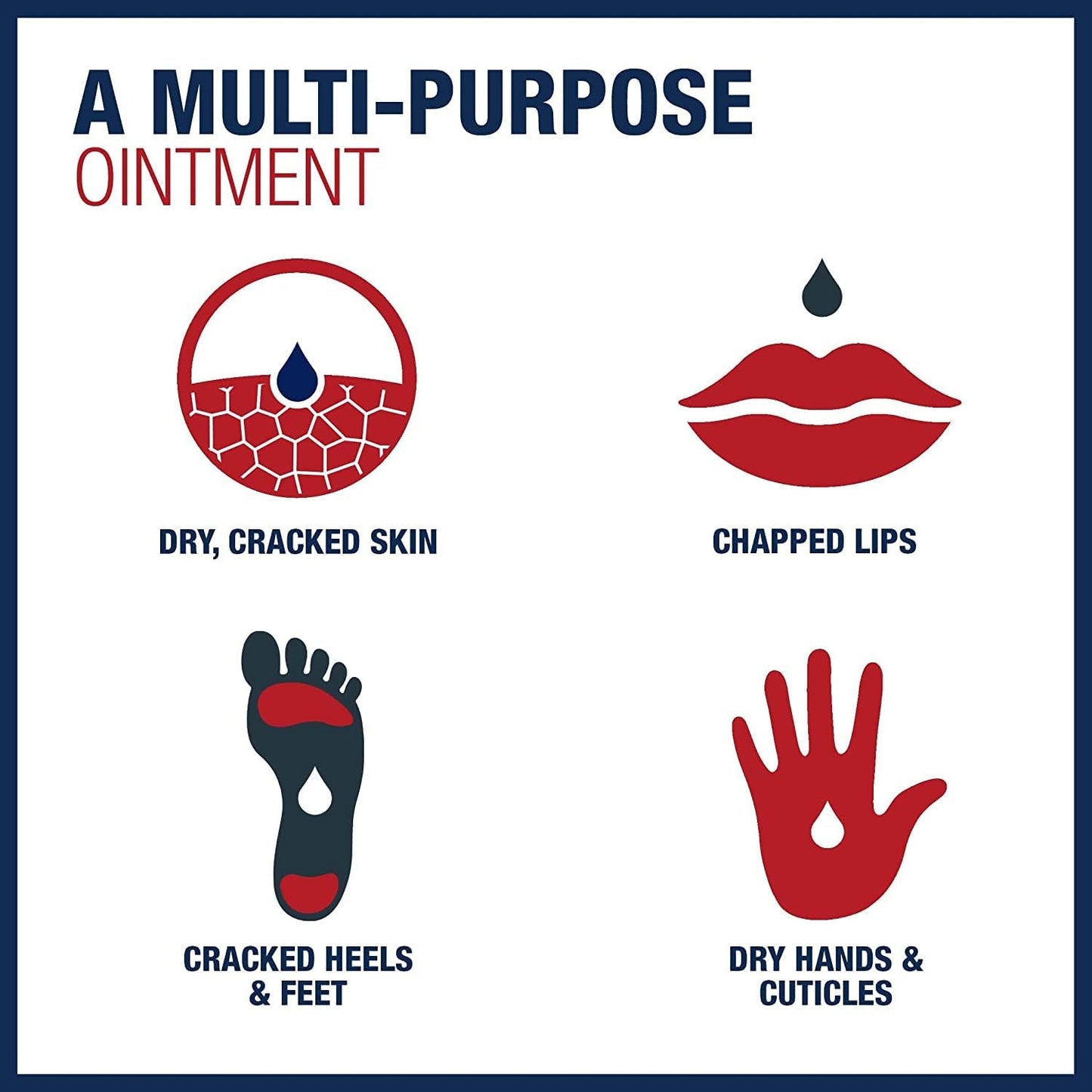 Aquaphor Healing Ointment - Pack of 6, Protectant for Dry Cracked Skin, Dry Hands, Travel Size - 1.75 oz. Tube