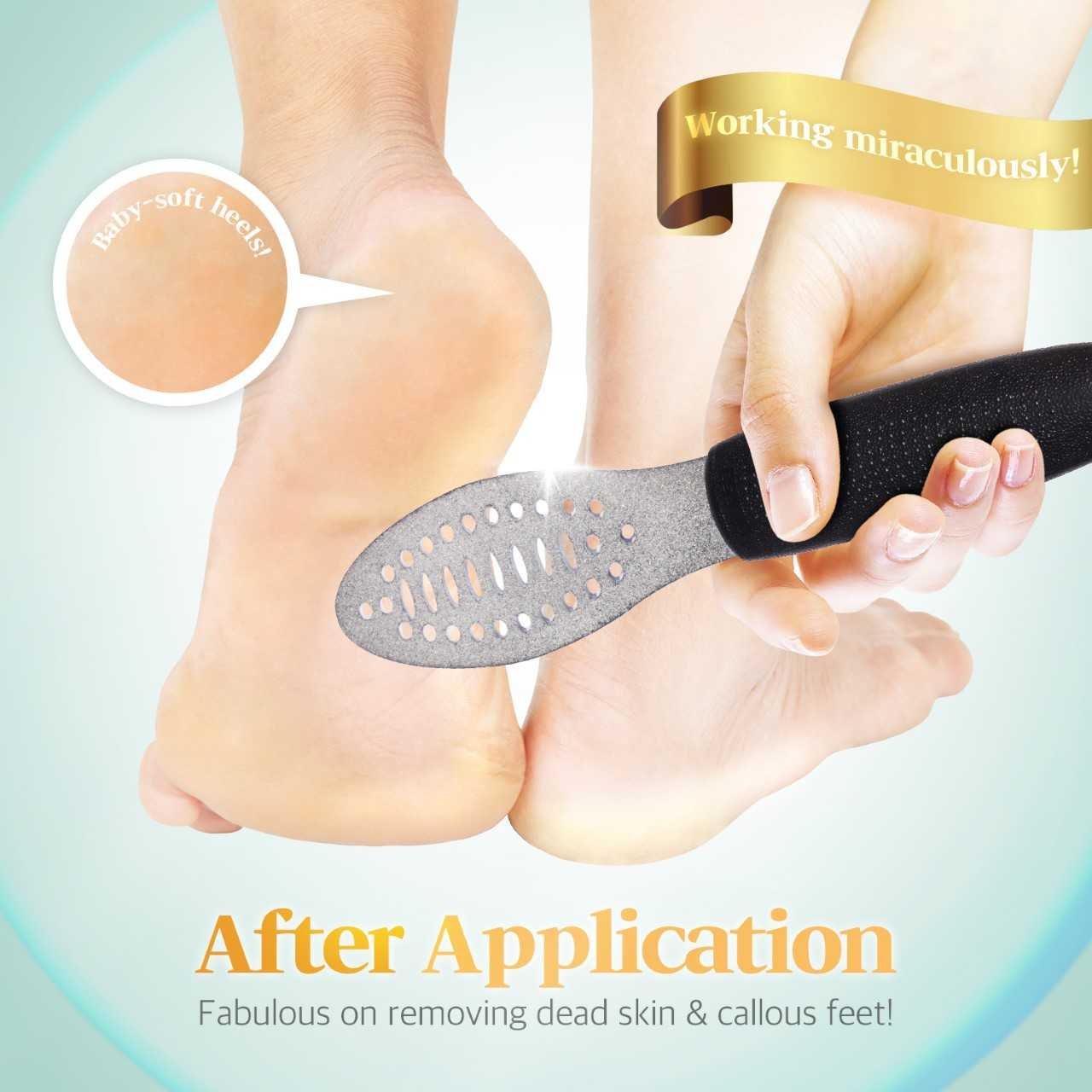Foxi Fresh 2-Sided Diamond Coated Foot Scrubber Callus Remover Foot File Foot Care