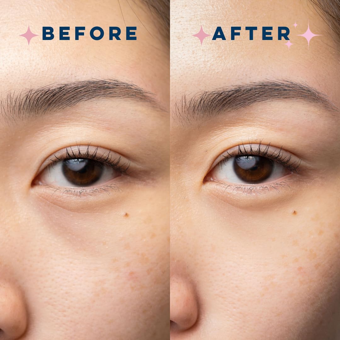 CLEAN SKIN CLUB Brightening+ Stem Cell Eye Cream, Reduces Dark Circles & Puffiness, Fragrance Free, 1.2 fl oz (Pack of 1)