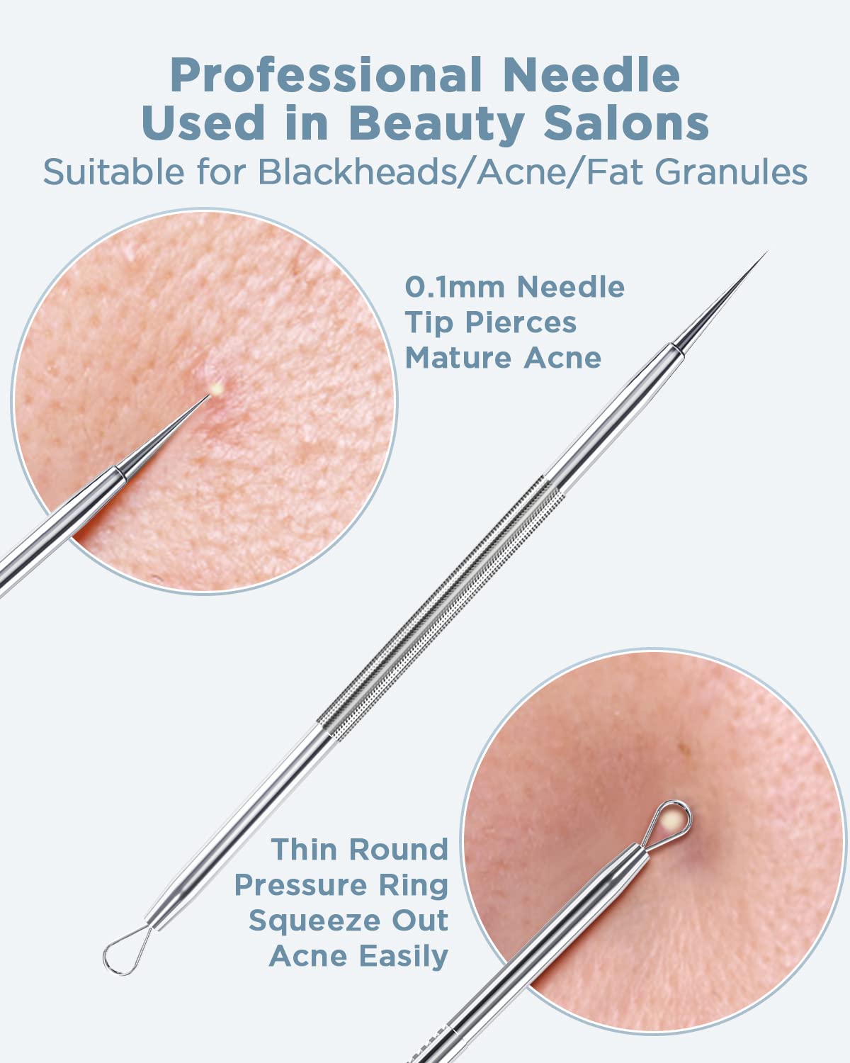 BESTOPE Blackhead Remover Blackhead Removal Pimple Comedone Extractor Tool - Treatment for Blemish Whitehead Popping Zit Removing with Metal Case