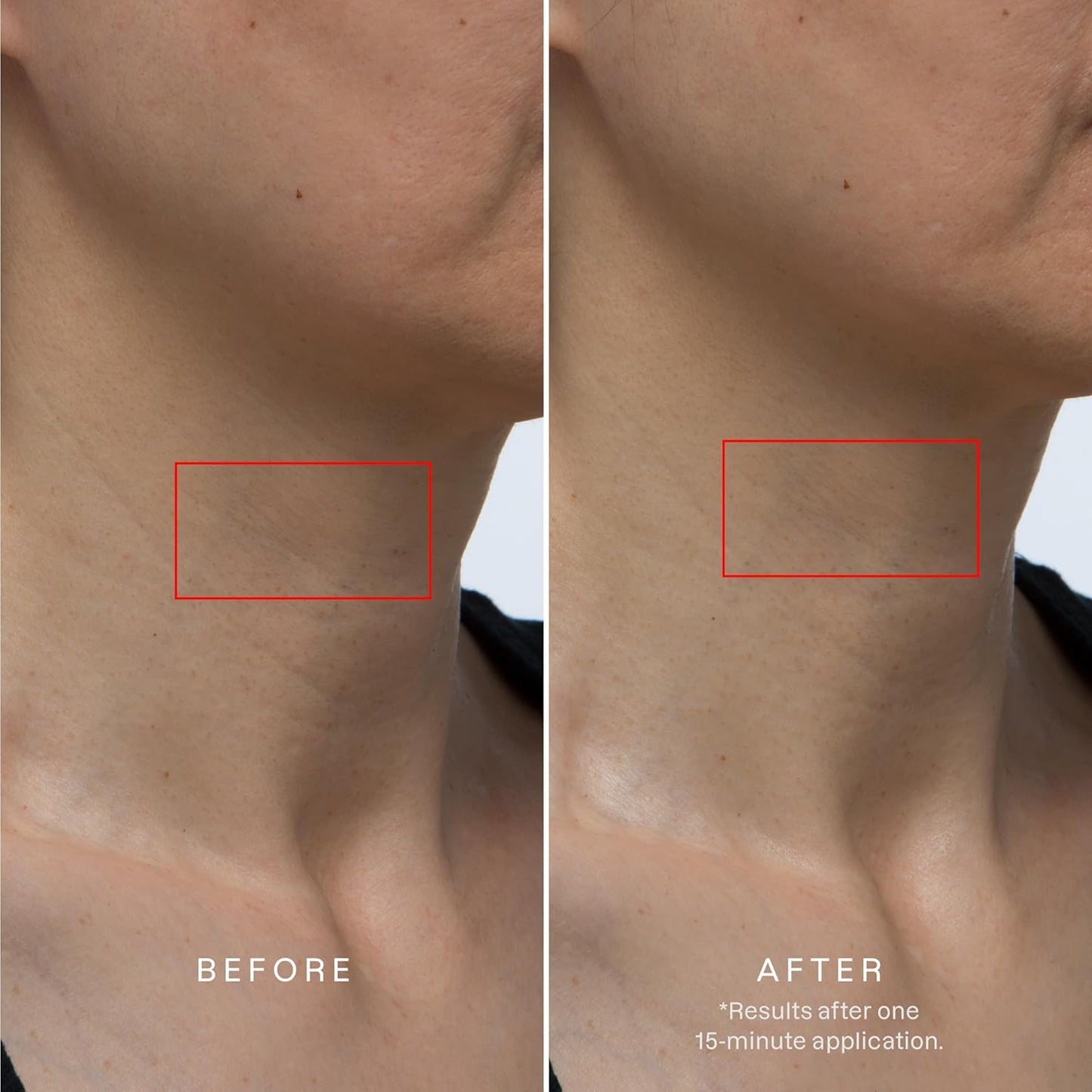 Karuna Collagen Neck & Chest Hydrogel Mask 1-Pack | Firming & Hydrating K-Beauty Masks with Collagen, Peptides & Niacinamide | For Wrinkles & Sagging