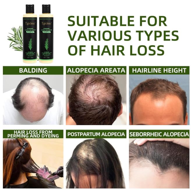 Tgideas Rosemary & Biotin Shampoo for Thinning Hair, Volumizing Shampoo for Fuller, Thicker Hair, Strengthening & Nourishing Formula with Root Lift Beauty and Personal Care Tgideas