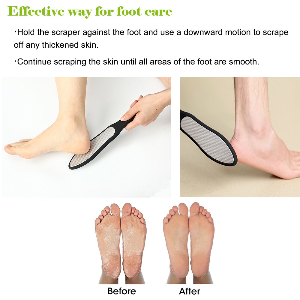BEZOX Foot File (1 PCS), Double Sided Foot Scraper Callus Remover, Foot Rasp for Cracked Heel and Foot Corn Removal, Stainless Steel Pedicure File
