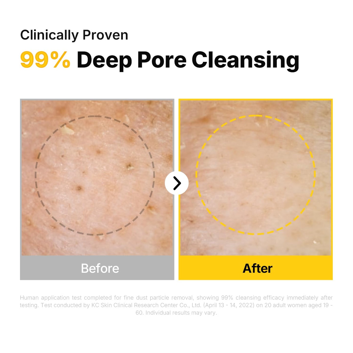 MANYO Pure Cleansing Oil, Natural Oil Cleanser for Face, Makeup Blackhead Remover, Korean Skin Care, 6.76 fl oz (200ml) Beauty and Personal Care ma:nyo