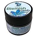 Diva Stuff Best Blemish Bomb Spot Treatment, Anti-acne spot treatment cream for Men and Women, 1/4 oz (Made in the USA)