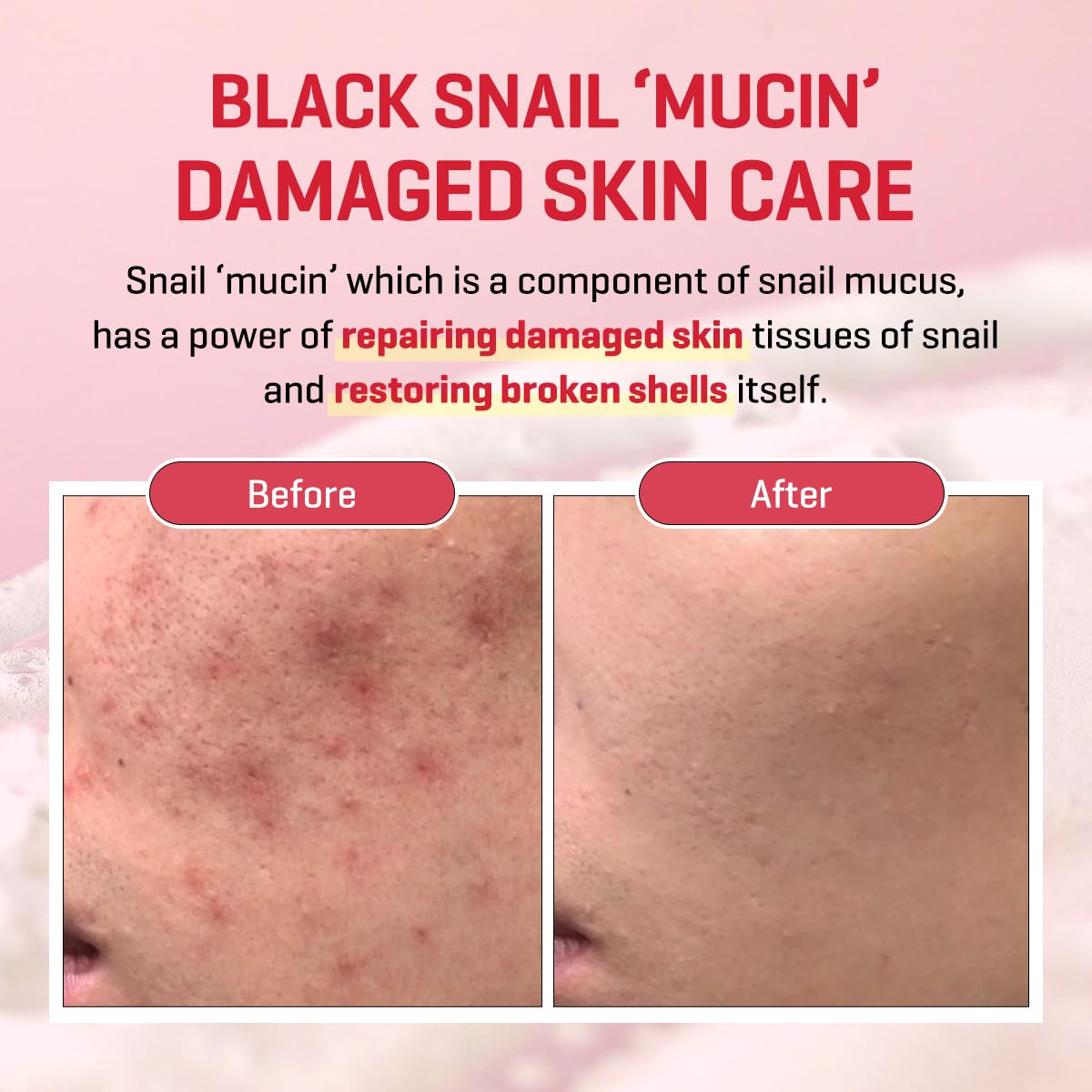 SOME BY MI Snail Truecica Miracle Repair Low pH Gel Cleanser - 3.38Oz, 100ml - Made from Snail Mucin for Sensitive Skin - Daily Face Wash for Deep