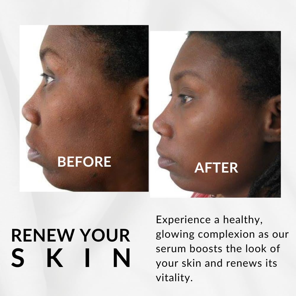 Perfect Tone Moisture Serum by Flori Roberts, Reduces Appearance of Dark Spots, Hyperpigmentation, Lines and Wrinkles, Boosts Radiance