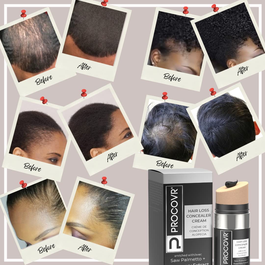 PROCOVR Hair Loss Concealer Cream - The ORIGINAL Thinning & Balding Hairline Enhancer, Hair Mascara for Natural Coverage & Thicker Appearance (Smoke