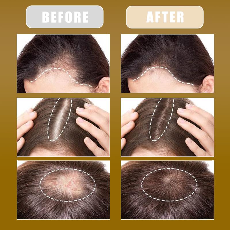 Batana Oil for Hair Growth, Natural Oil from Honduras, Batana Mask Batana Miracle Loss, Repairs Damaged, Leaves Smoother, Adds Shine (4.15 oz)