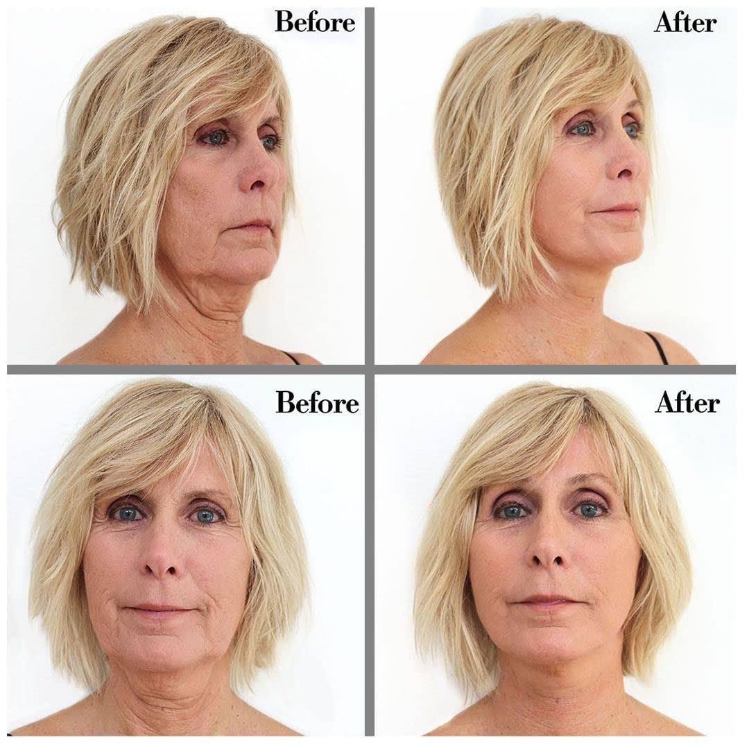 Bring It Up Instant Face Lift Tape Kit: 30-Day Supply, Transparent Neck & Eyebrow Lift Strips, Anti-Wrinkle Stickers, Face Tape Instantly Lifts