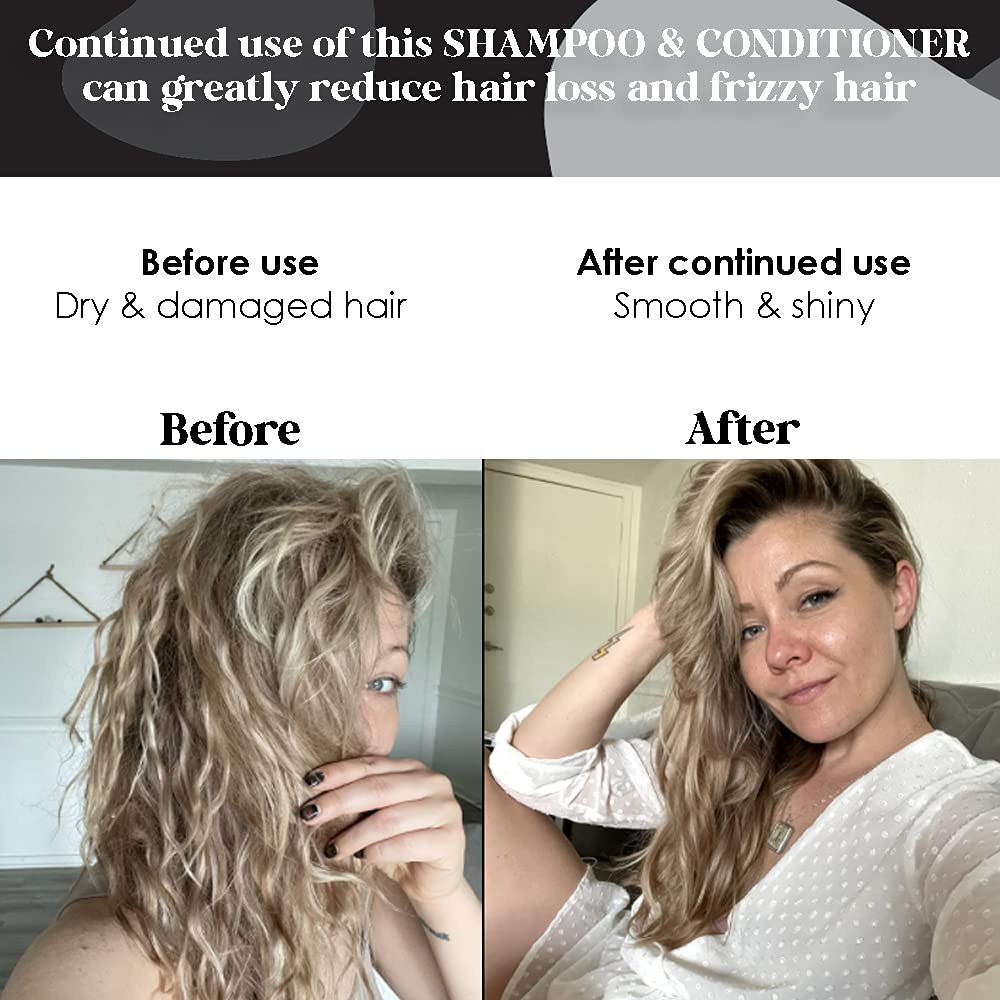Biotin For Hair Growth Shampoo, Conditioner & Leave In Serum Treatment Box Set, Anti Hair Loss System for Thinning Hair Aloe Vera, Cucumber B. The
