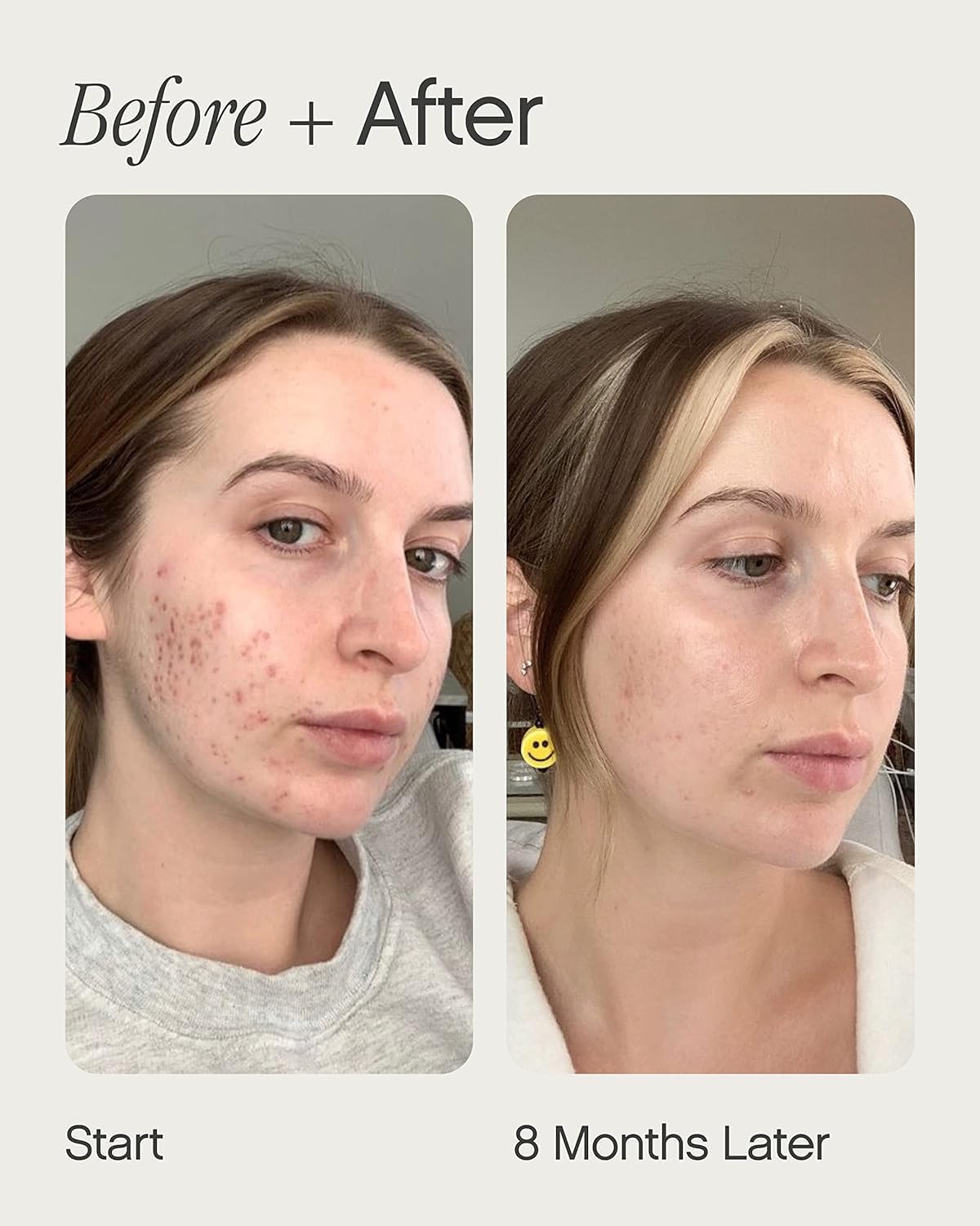 Topicals Faded Brightening and Clearing Serum | Reduces Discoloration, Post-Blemish Marks, Scars and Spots | Contains Kojic Acid and Niacinamide | Beauty and Personal Care Topicals