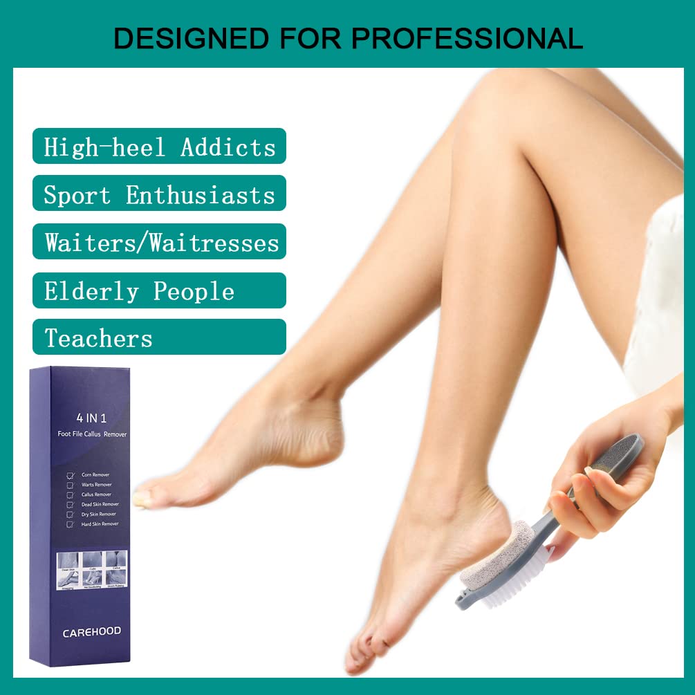 CAREHOOD Foot File Callus Remover - Multi Purpose 4 in 1 Feet Pedicure Tools with Foot Scrubber, Pumice Stone, Foot Rasp and Sand Paper for Home Foot