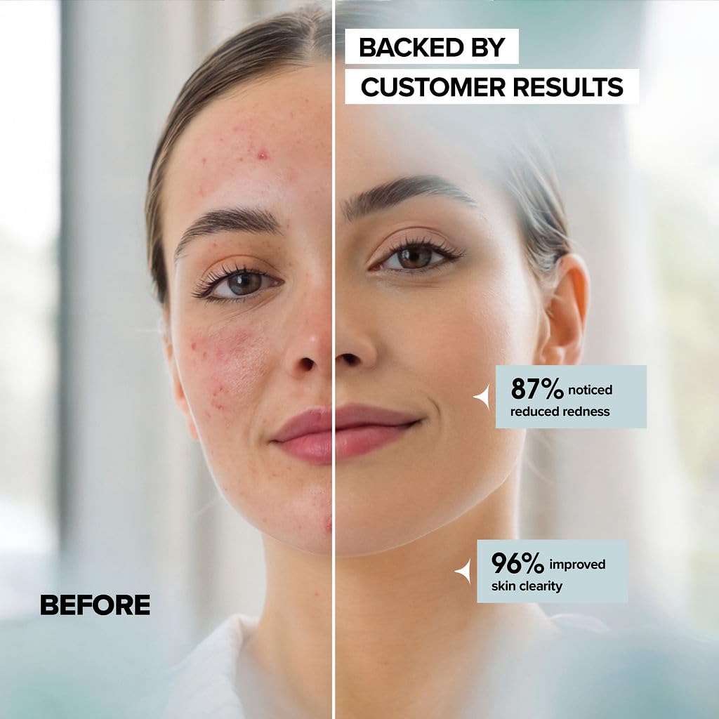 Face Towels - Ultra Soft and Thick Disposable Face Towelettes for Women - Biodegradable Facial Towels for Sensitive Skin - Face Cleansing, Makeup