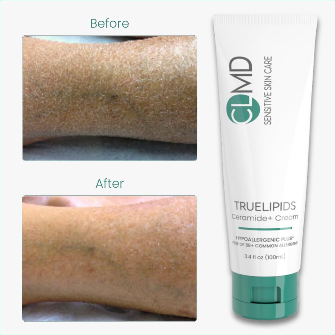CLMD TrueLipids Ceramide+ Cream - Deep Moisturizing Barrier Support for Sensitive Skin - Hydrates and Soothes - Hypoallergenic, Nourishing